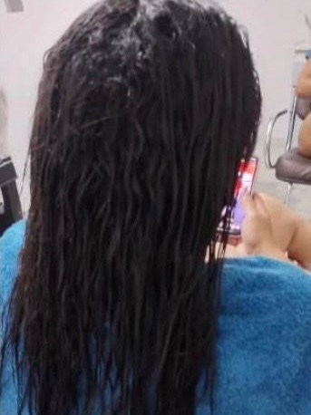 Antes 1