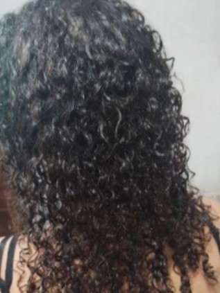 Antes 2